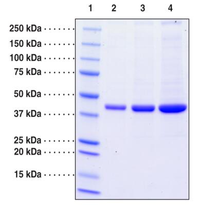 Lane 1: MW Markers<br />Lane 2: Prorenin (1 μg)<br />Lane 3: Prorenin (2 μg)<br />Lane 4: Prorenin (4 μg)
